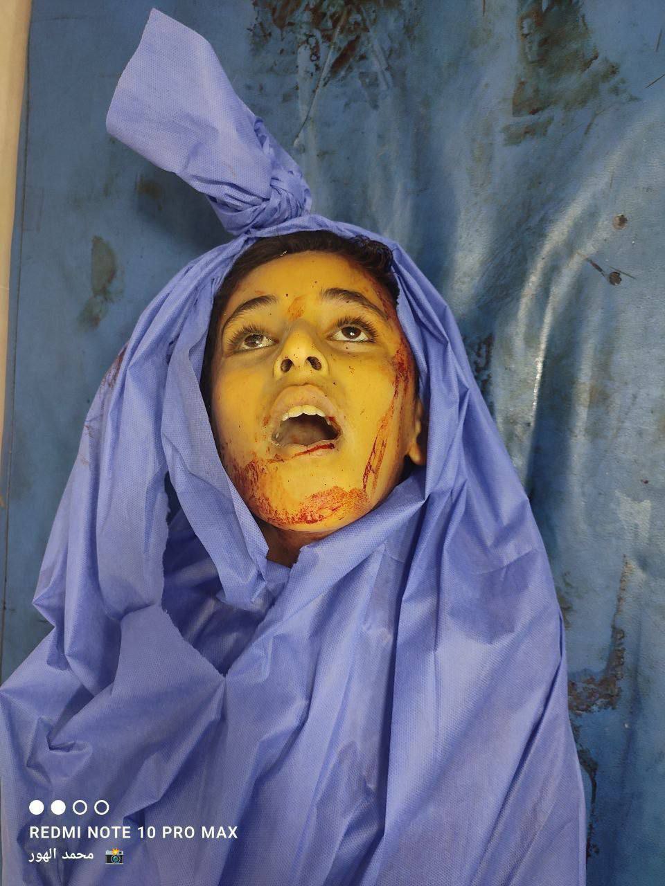 Among them are children .. martyrs and injuries of... Photo 2025 07 30 04 12 57