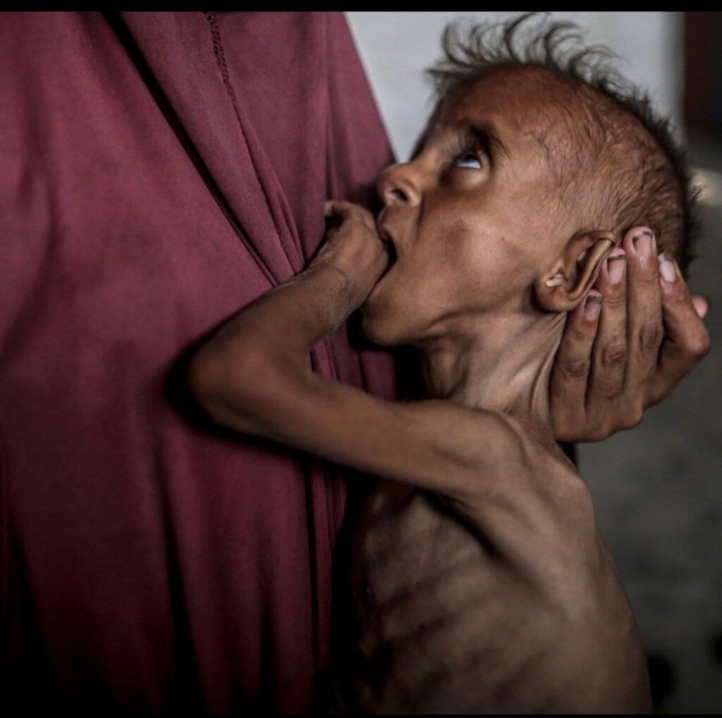 Hunger Silences Childhood in Gaza Photo 5791987269987583832 Y 1024x1018