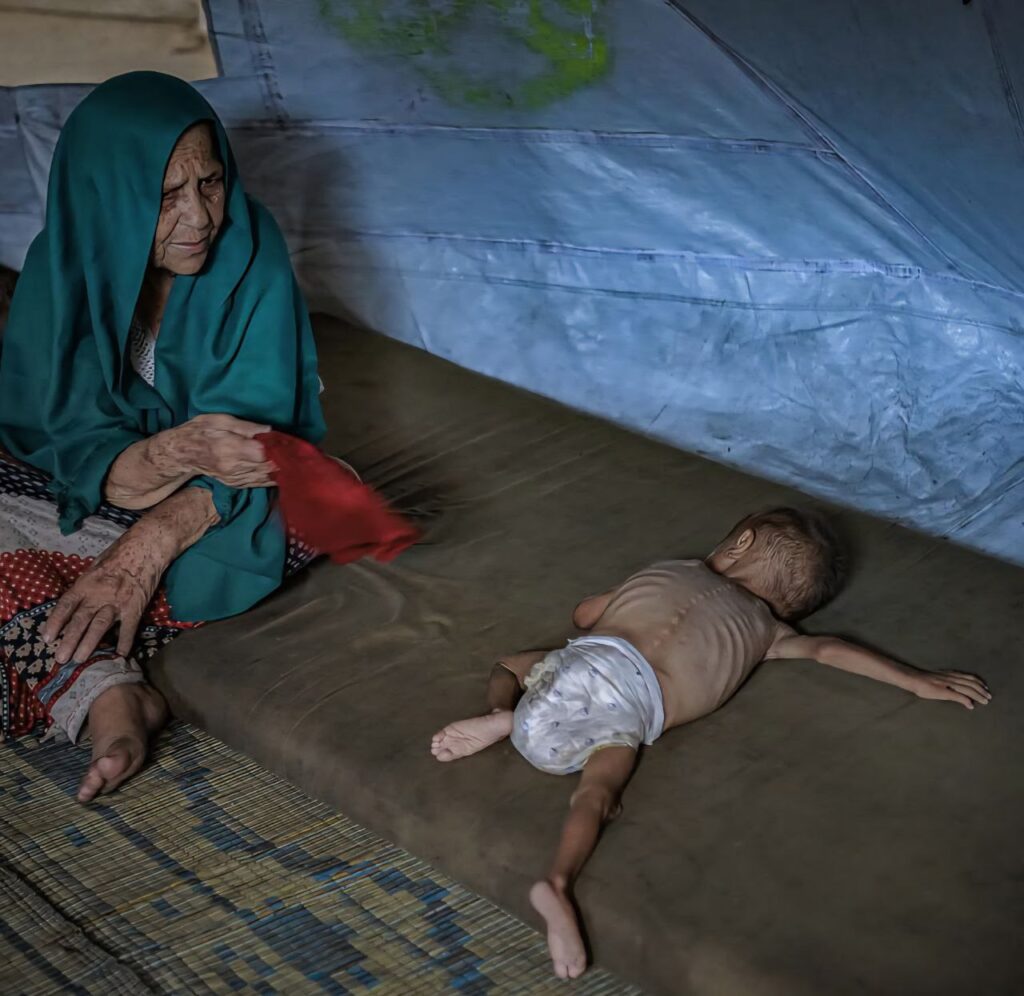 "Gaza’s Starving Children Face Death Amid Shells, Hunger, and Silence" Photo 6089271291170375171 Y 1024x996