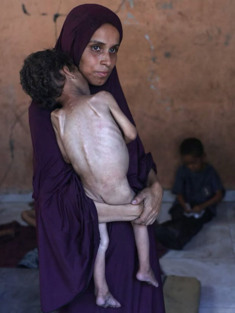 In Gaza, Hunger Strips Children of Flesh, Childhood, and Dreams Photo 6091523090984062059 Y 769x1024